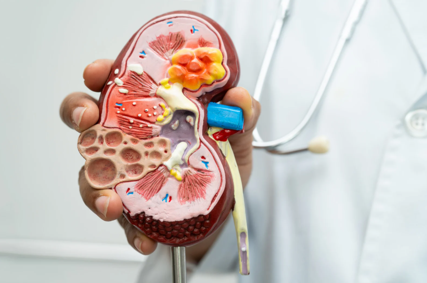 신장질환 조기 발견